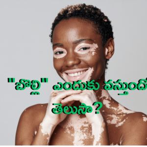 Read more about the article ఆరోగ్యానికి కీడు చేసే ‘విరుద్ధమైన ఆహార పదార్ధాల కలయిక ‘! “బొల్లి” ఎందుకు వస్తుందో తెలుసా? ఆయుర్వేదం చెప్పే ‘రసా’ సిద్ధాంతం!