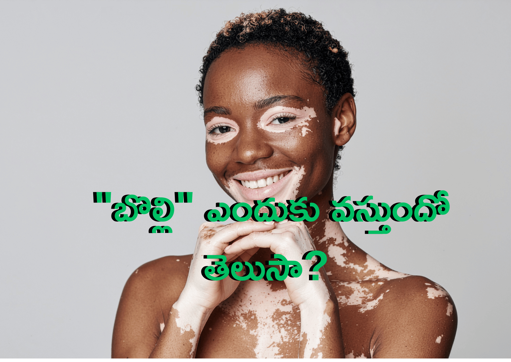 Read more about the article ఆరోగ్యానికి కీడు చేసే ‘విరుద్ధమైన ఆహార పదార్ధాల కలయిక ‘! “బొల్లి” ఎందుకు వస్తుందో తెలుసా? ఆయుర్వేదం చెప్పే ‘రసా’ సిద్ధాంతం!